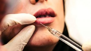 Botox Bar, apre il primo caffè in Italia dove è possibile ordinare trattamenti estetici
