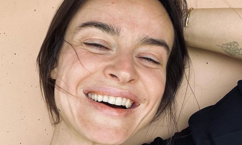 Kasia Smutniak e la vitiligine: “Sto da Dio, mi sento amata e bella”