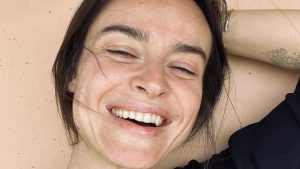 Kasia Smutniak e la vitiligine: “Sto da Dio, mi sento amata e bella”