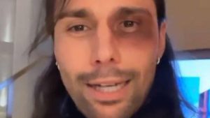 Luca Onestini sulla rissa a Parigi: “Mai avvenuta, basta fake news”