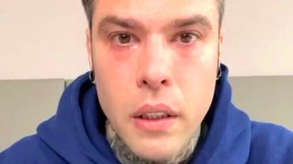 "Fedez operato al San Raffaele di Milano" 42 Fedez operato a Milano