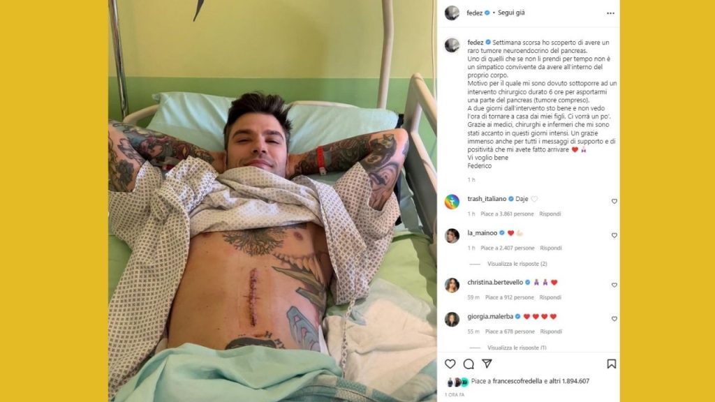 Fedez tumore pancreas Instagram