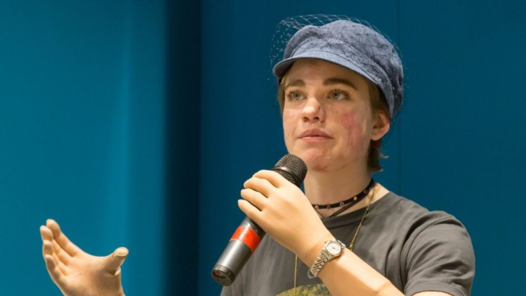 Bebe Vio: il bacio con un ragazzo misterioso a Napoli 43 bebe vio