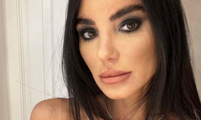 Chiara Biasi Instagram ritocchi filler viso