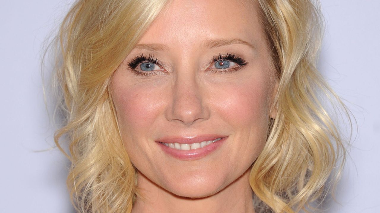 anne heche condizioni