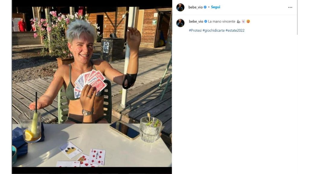 Bebe Vio: "La mano vincente", lo scatto che fa impazzire i fan 42 bebe vio