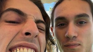 Damiano David mostra i denti d’oro: il nuovo look del leader dei Maneskin