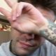 fedez tumore