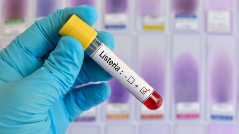 listeria