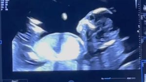 Sophie Codegoni è incinta: l’annuncio insieme ad Alessandro Basciano