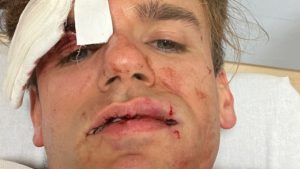 Jacopo Malnati de iPantellas massacrato da due rapinatori: “Mi hanno messo la pistola alla tempia”