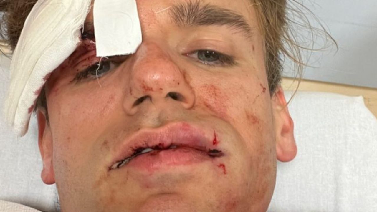 Jacopo Malnati de iPantellas massacrato da due rapinatori: "Mi hanno messo la pistola alla tempia" 41 Jacopo Malnati