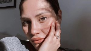 Beatrice Valli mostra lo sfogo sul viso: l’imprevisto a qualche ora da Sanremo