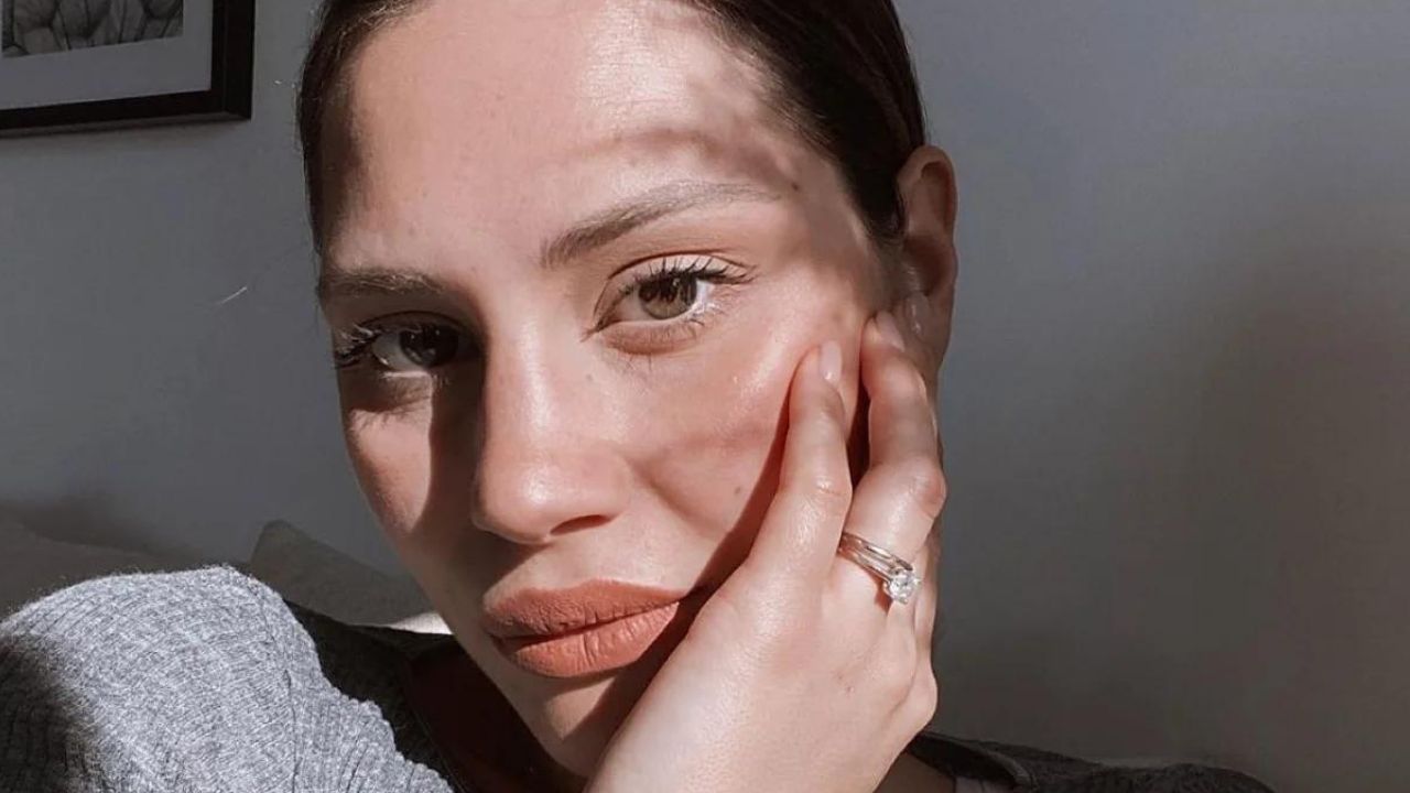 Beatrice Valli mostra lo sfogo sul viso: l'imprevisto a qualche ora da Sanremo 41 beatrice valli sanremo