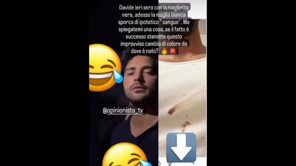 Davide Donadei, i post e il sangue: cosa è accaduto all'ex gieffino? 42 Davide Donadei