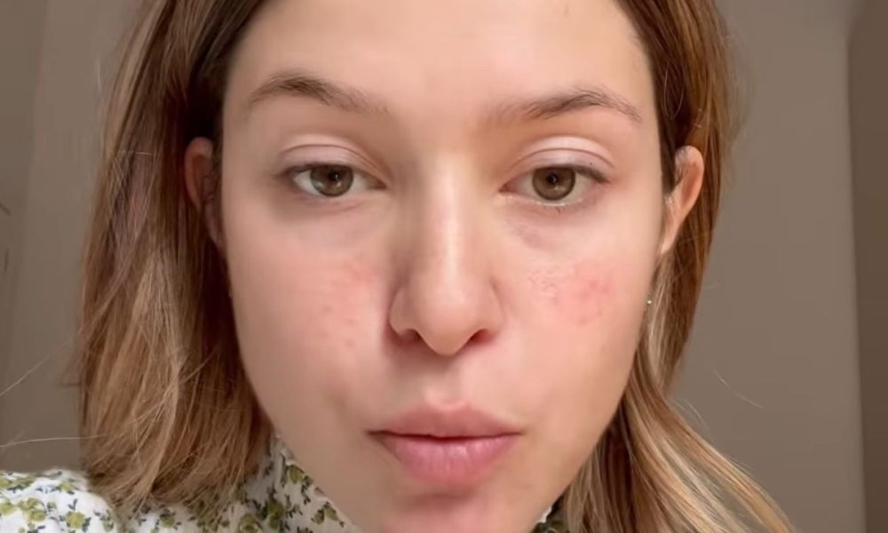 Natalia Paragoni in pronto soccorso: “Se il dolore continuerà, dovrò tornare”