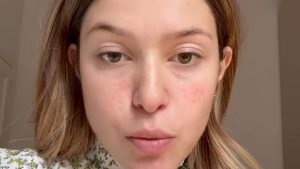 Natalia Paragoni in pronto soccorso: “Se il dolore continuerà, dovrò tornare”
