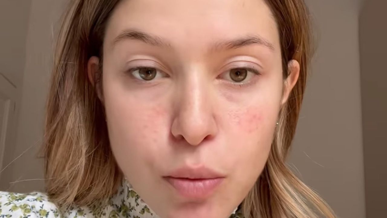 Natalia Paragoni in pronto soccorso: "Se il dolore continuerà, dovrò tornare" 41 natalia paragoni pronto soccorso