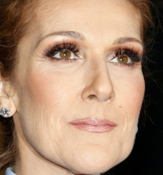 celine dion malattia come sta