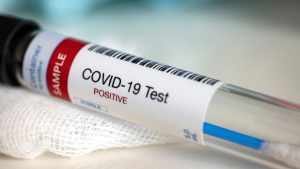Covid, la pandemia è finita: “Non è più emergenza globale”