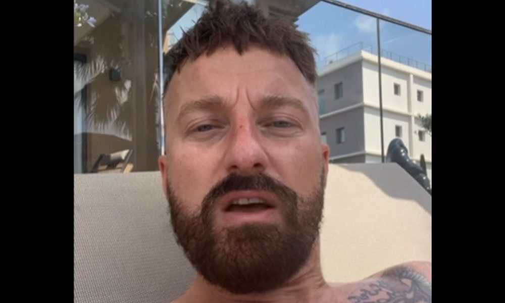 Francesco Facchinetti, il trapianto di capelli è un flop: “10mila euro buttati”