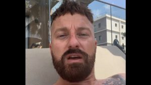 Francesco Facchinetti, il trapianto di capelli è un flop: “10mila euro buttati”