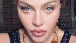 Come sta Madonna: ultimi aggiornamenti sulle sue condizioni
