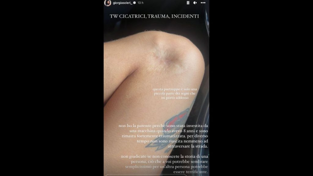 Perché Giorgia Soleri non ha la patente: "Sono stata investita a 8 anni" 42 giorgia soleri patente