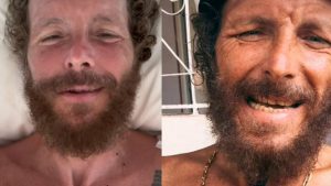 Paura per Jovanotti, brutto incidente in bici: “Rotto clavicola e femore”
