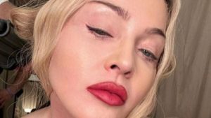 Madonna, lanciato l’allarme: “Finirà come Michael Jackson”