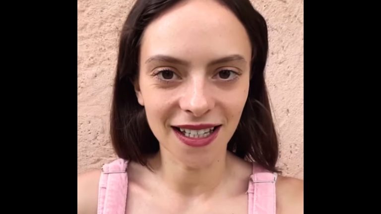 francesca michielin operata