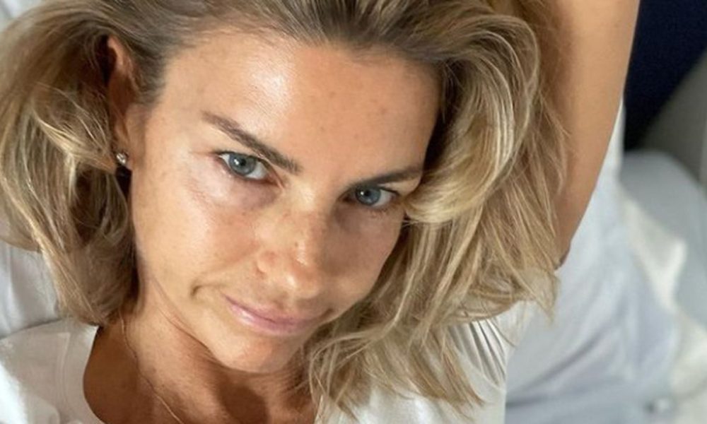 Martina Colombari criticata sui social per la terapia anti-age