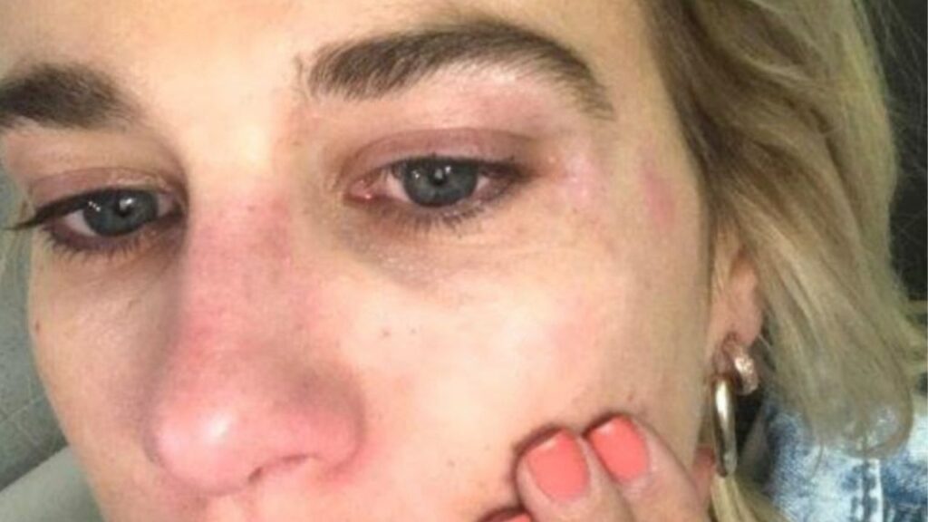 clizia incorvaia violenza