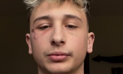 george ciupilan aggredito