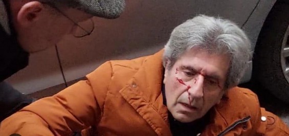 gianni ippoliti aggressione
